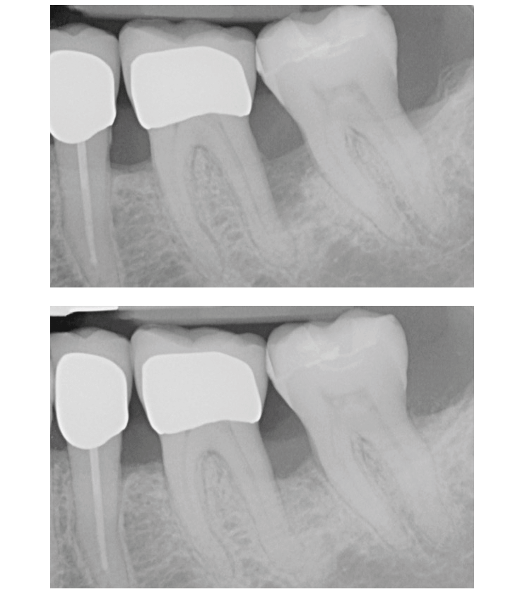 Parodontitis systematisch behandeln