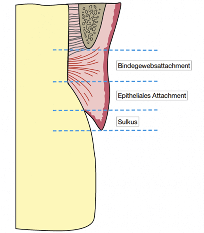 Präprothetische Behandlungen
